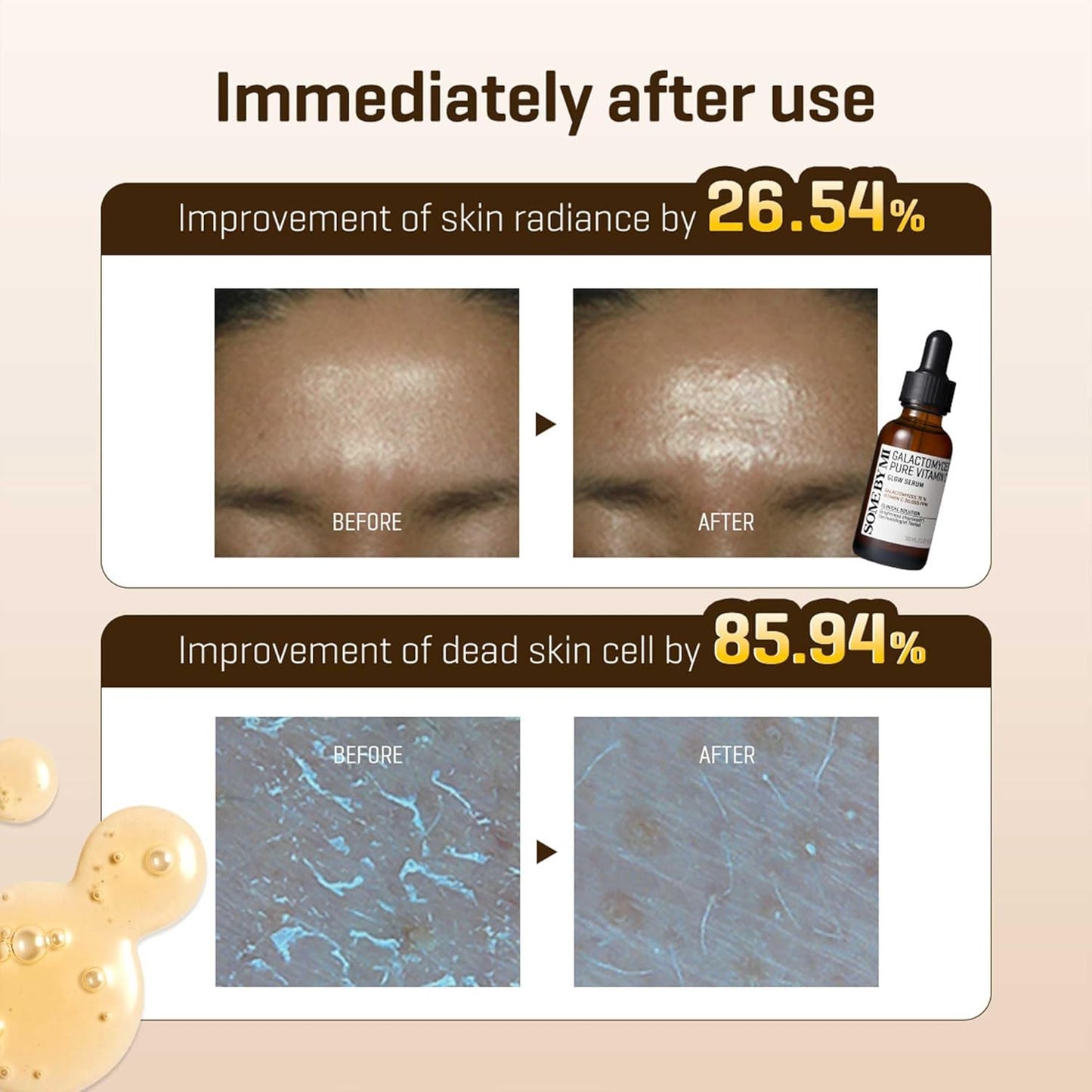 SOME BY MI Galactomyces Pure Vitamin C Glow Serum - 1.01Oz, 30ml
