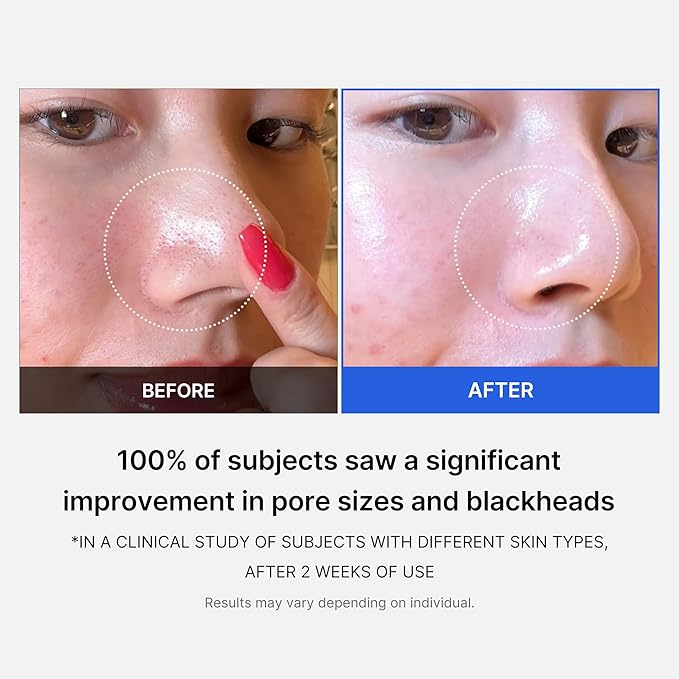 Medicube zero pore pad 2.0 155 g / 5.46 oz / 70 pads