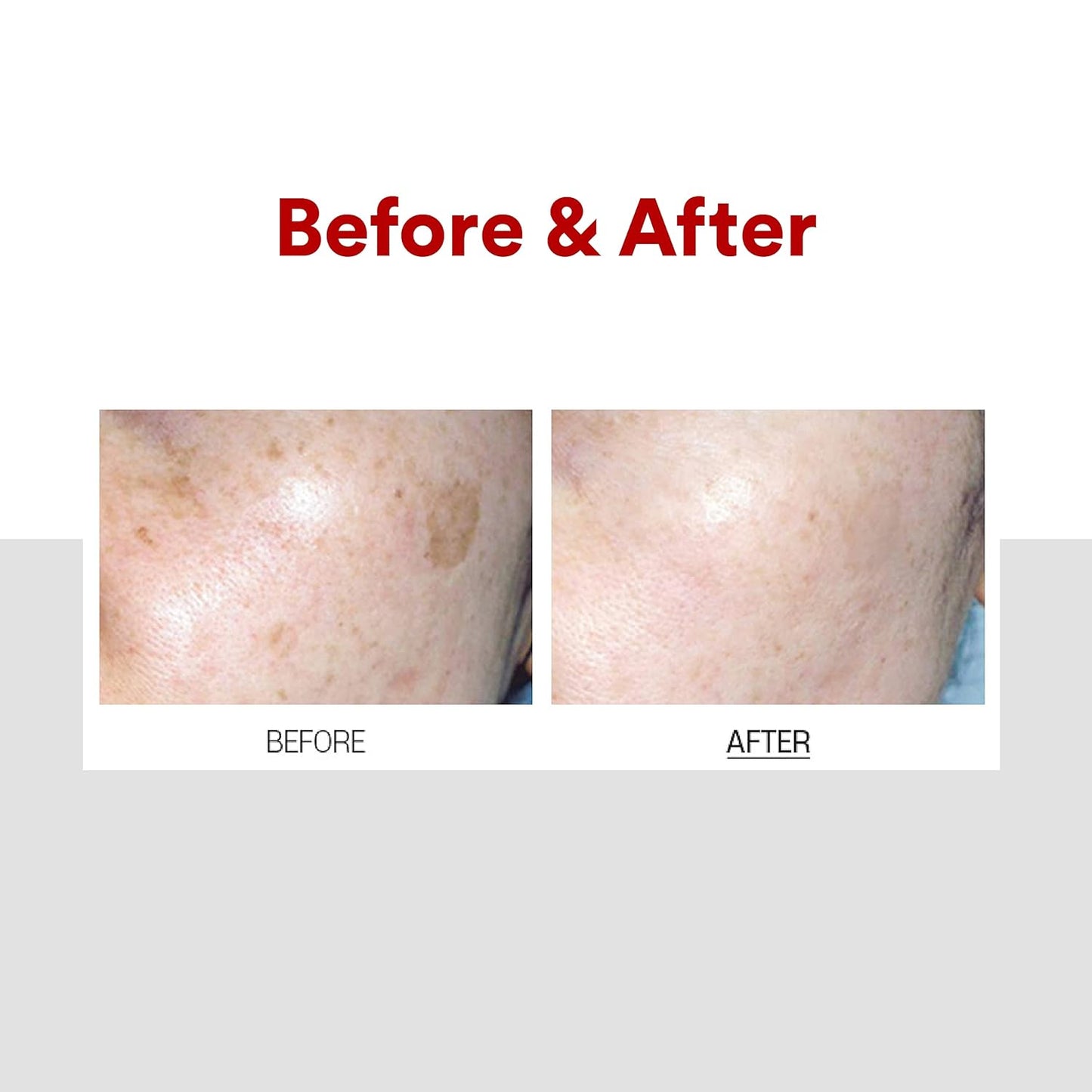 Medi-peel melanin x cream 30 ml