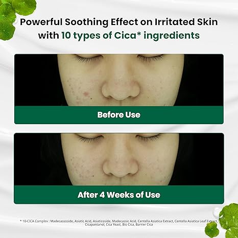 Dr.G R.E.D Blemish clear soothing cream 70ml / 2.36fl.oz.