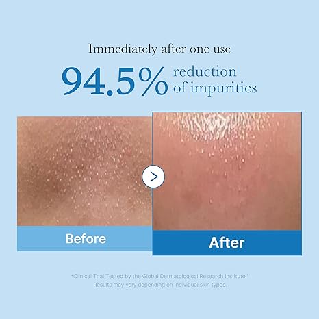 Medicube zero pore blackhead deep cleansing oil 205 ml / 6.93 fl.oz.