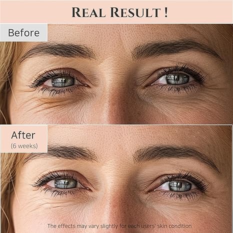 Beauty of joseon revive eye serum ginseng + Retinol 30 ml / 1.01 fl.oz.