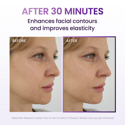 Probioderm™ 3D Lifting Full Face Tension Gel Mask