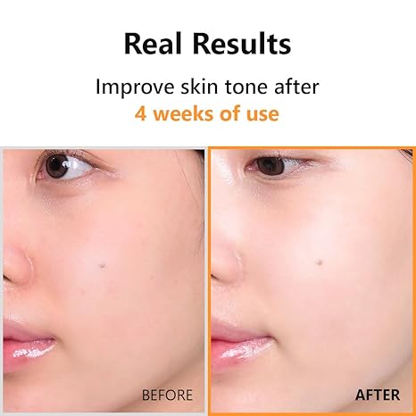 Isntree Hyper vitamin C 23 serum 20 ml