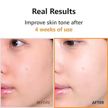 Isntree Hyper vitamin C 23 serum 20 ml