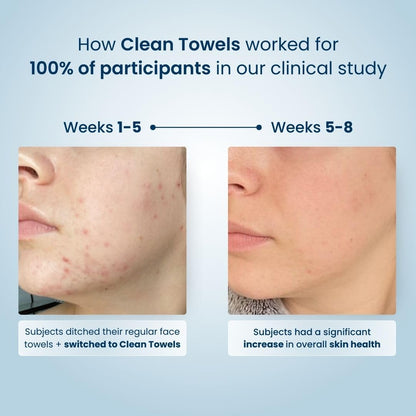 Clean Skin Club Clean towels