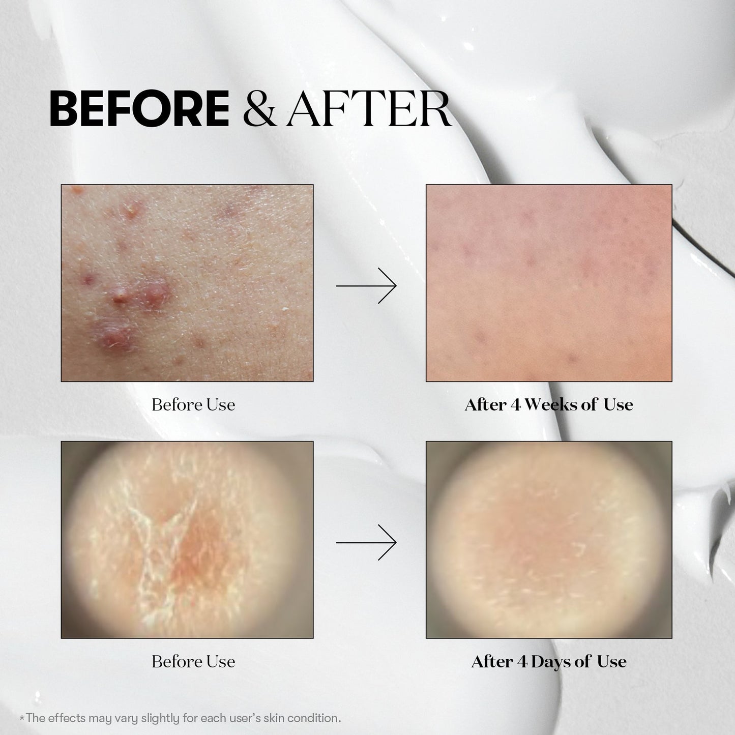 VT cosmetics reedle shot 700 30ml / 1.01 fl. oz.