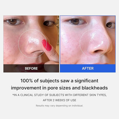 Medicube zero pore pad 2.0 155 g / 5.46 oz / 70 pads