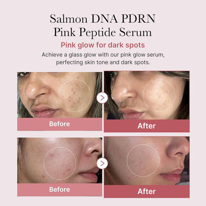 medicube PDRN Pink Peptide Serum  1.01 fl.oz.