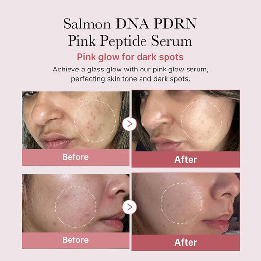 medicube PDRN Pink Peptide Serum  1.01 fl.oz.