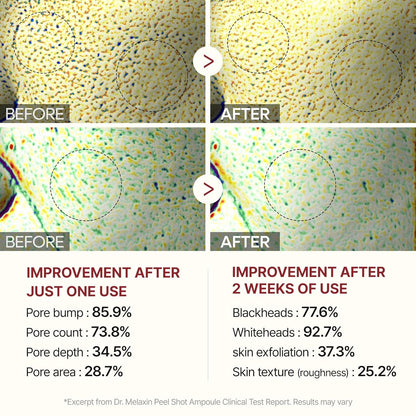 Dr. Melaxin Peel Shot Exfoliating Black Rice Ampoule