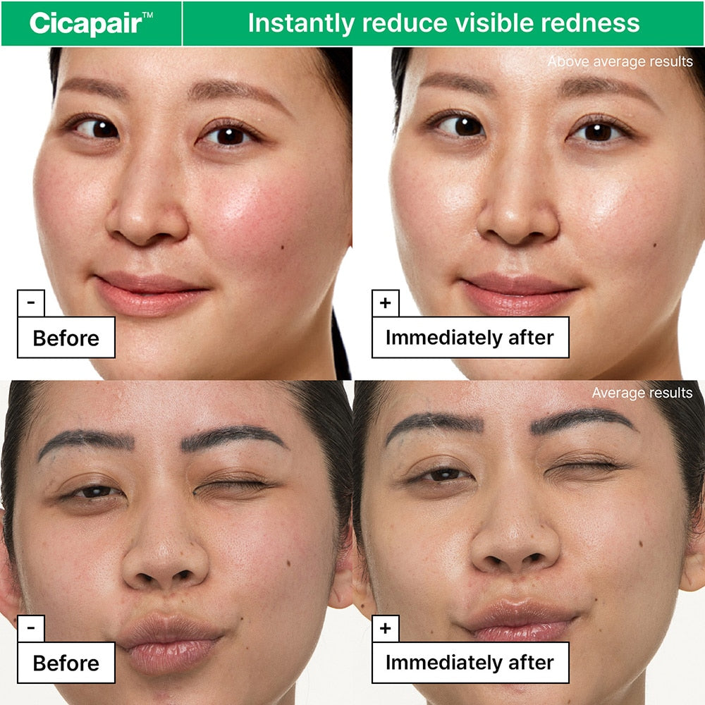 Cicapair™ Sensitive Skin Moisturizer for Redness