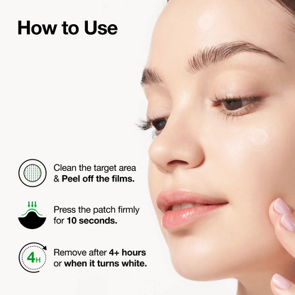 Anua Triple Acid Spot Care Microdart Patch