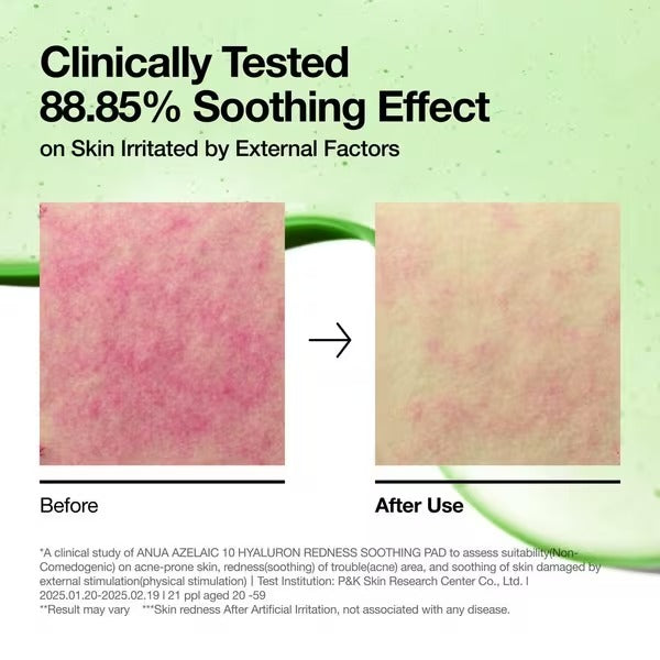 Anua Azelaic Acid 10+ Hyaluronic Redness Soothing Pad